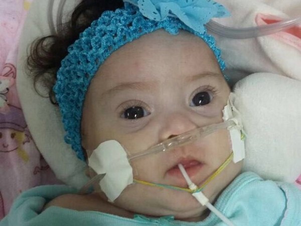 A bebê Elisa Teixeira, que aguarda por cirurgia no coração (Foto: Érica Teixeira/Arquivo Pessoal)