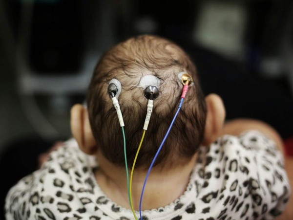 Bebê com microcefalia passa por exame na USP, em São Paulo.  (Foto: Nacho Doce/Reuters)