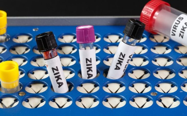 Testes de detecção do zika vírus serão cobertos pelos planos de saúde.